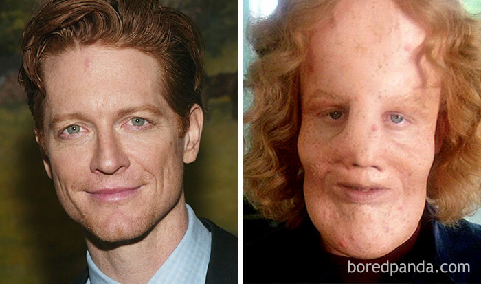 Eric Stoltz - Rocky Dennis - Neomag.