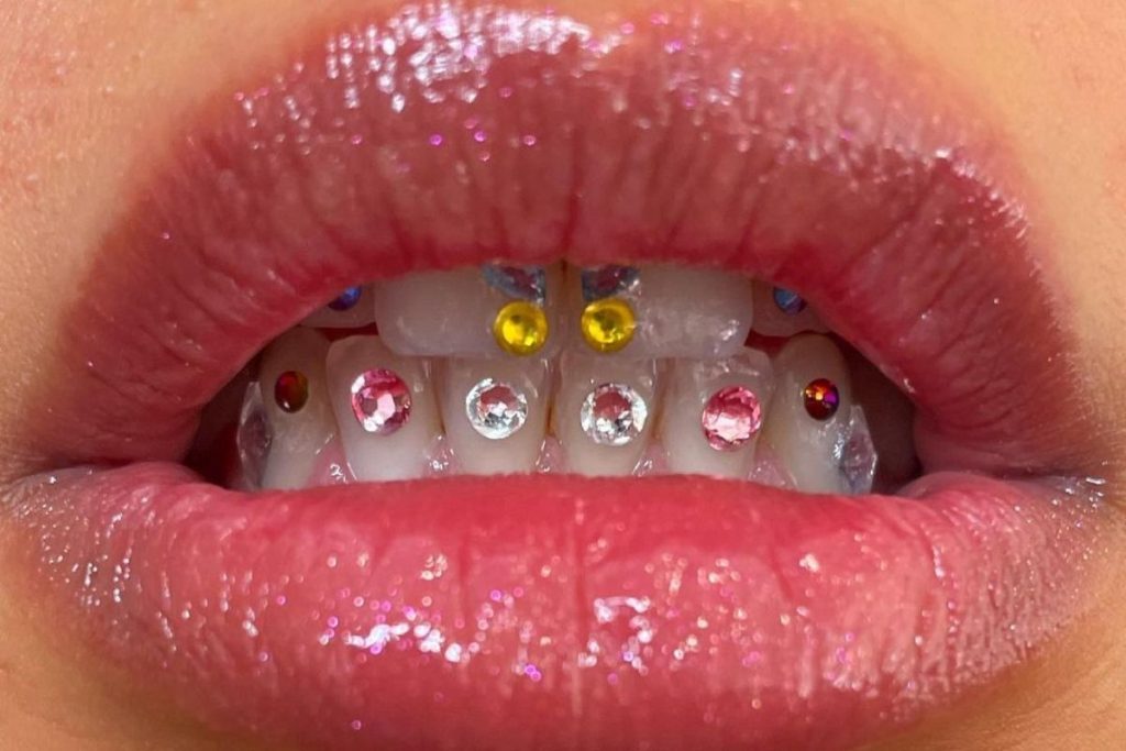 tooth gems - neomag.
